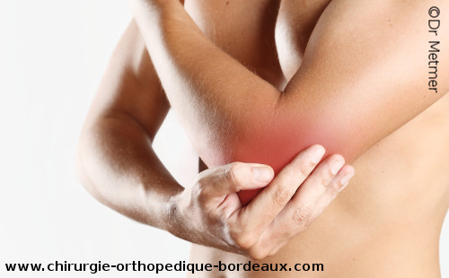 Douleur aigue du coude en raison d'une épicondylite.  Acute elbow pain, Tennis-Elbow.  急性肘疼痛。
